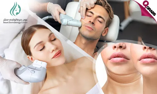 HIFU Skin Tightening at Aoun Dermatology Center!